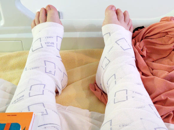 Photo bandes sur les jambes