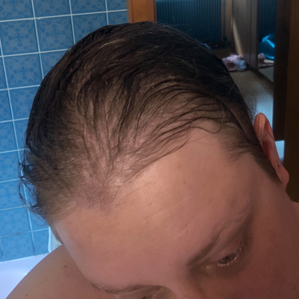 Photo de mes cheveux pendant la chimio